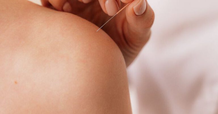 Can Acupuncture Promote Better Health?